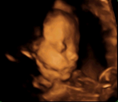 Baby Imaging on 4d Ultraschall   Group Picture  Image By Tag   Keywordpictures Com